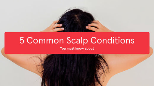 5 most common scalp conditions you must know about. Image banner showing a woman's long black hair.