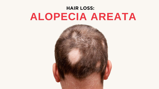 Alopecia Areata:  What are the Signs & Treatments available