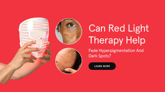 Can Red Light Therapy Help Fade Hyperpigmentation and Dark Spots?