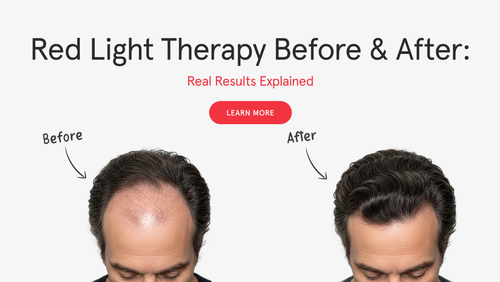 Red Light Therapy Before & After: Real Results Explained