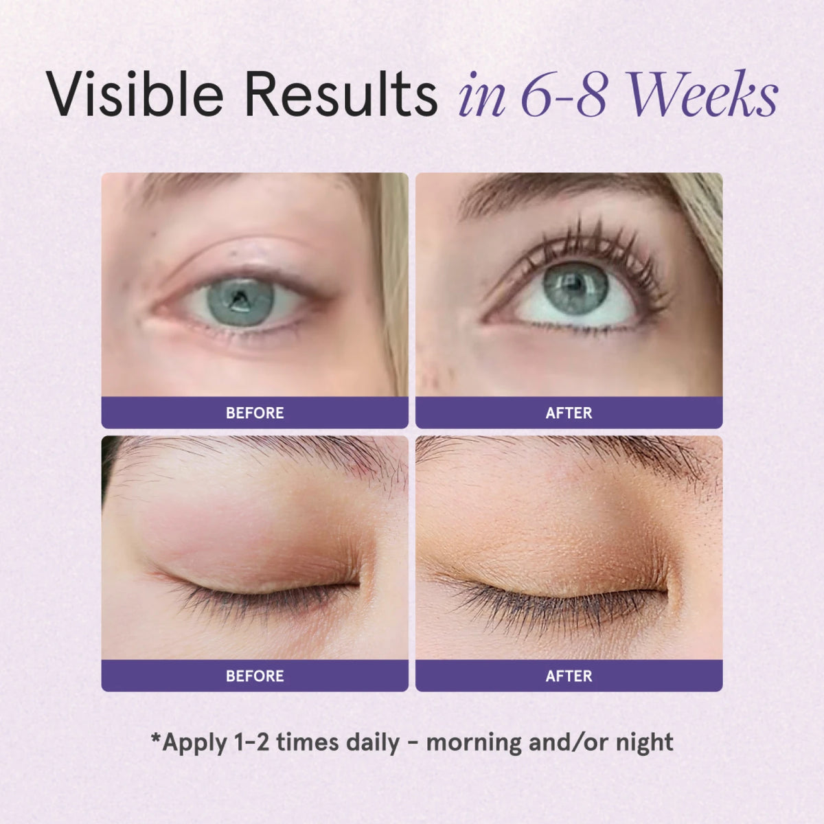 Visible results in 6 to 8 weeks. 1st set of images showing before and after comparison of woman's eyelashes with eyes open. 2nd set of images showing before and after comparison of woman's eyelashes with eyes closed. Apply 1 to 2 times daily - morning and/or night
