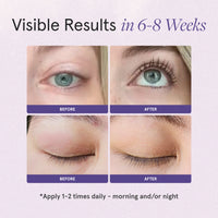 Visible results in 6 to 8 weeks. 1st set of images showing before and after comparison of woman's eyelashes with eyes open. 2nd set of images showing before and after comparison of woman's eyelashes with eyes closed. Apply 1 to 2 times daily - morning and/or night
