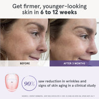 Side-by-side comparison of a woman’s profile showing visible improvements after using the iRESTORE LED face mask for 3 months, with a clinical study statistic highlighting 90% of users experienced reduced signs of aging