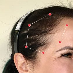 After image of a woman showing the her temples with more thicker hair.