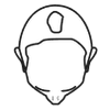 Image of Androgenic Alopecia Example