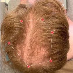 Top down view before image of a man with a thinning hair in his crown.