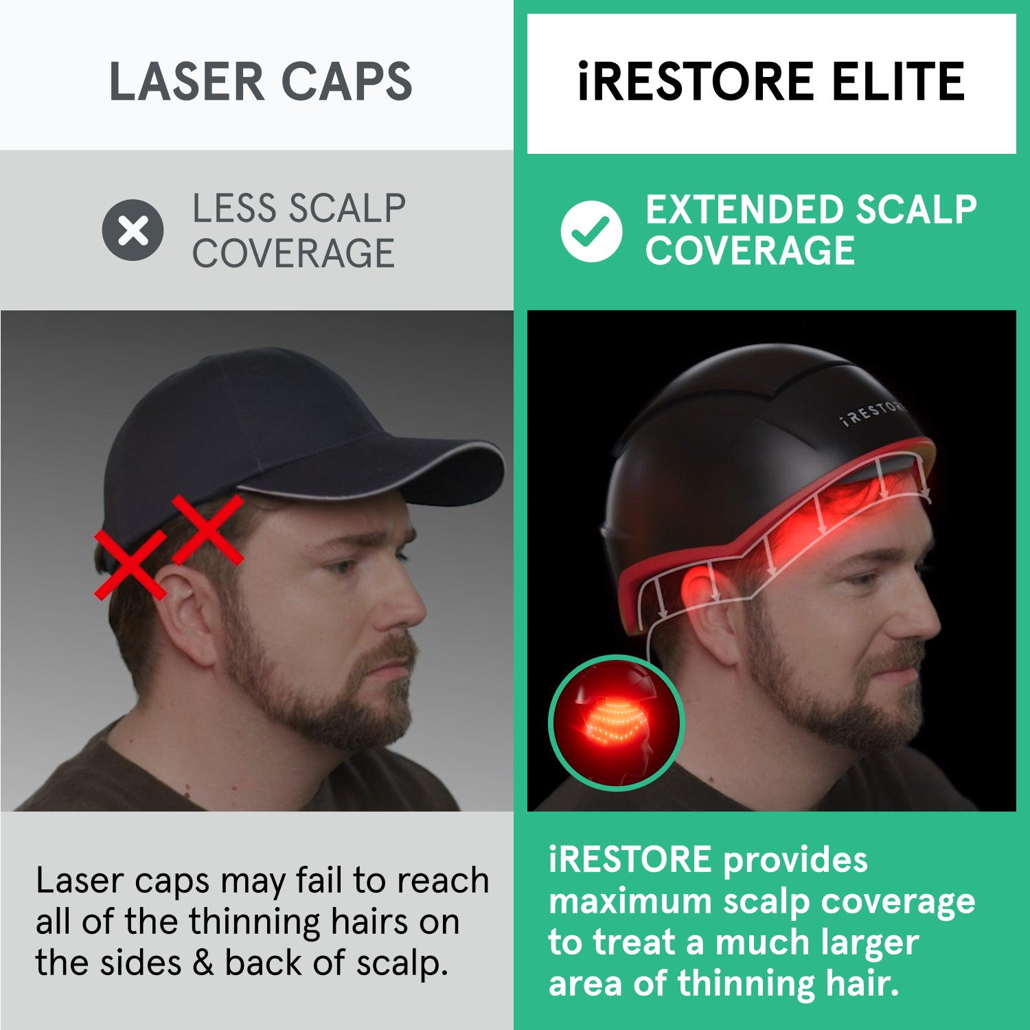 An image comparing the iRESTORE Elite with other laser cap. Laser caps only have less scalp coverage, laser caps may fail to reach all of the thinning hairs on the sides and back of scalp. While the Elite device have extended scalp coverage. it provides maximum scalp coverage to treat a much larger area of thinning hair.