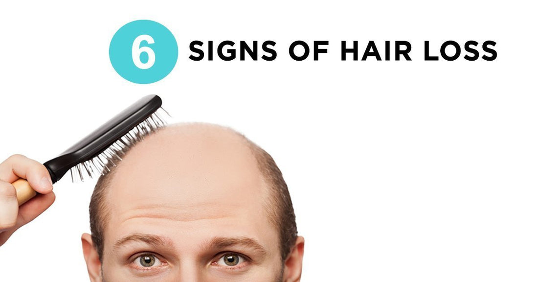 6 Early Signs You’re Going Bald & 6 Ways to Fight It
