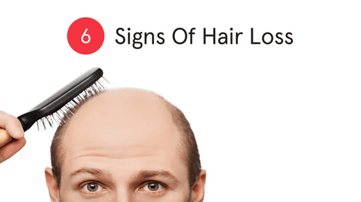 6 signs of hair loss. Man with bald area combing his hair.