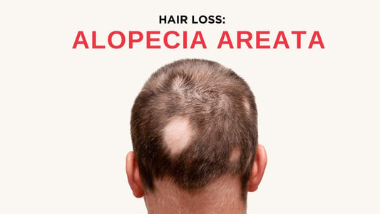 Alopecia Areata:  What are the signs& Treatments available