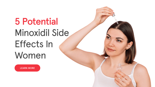 5 Potential Minoxidil Side Effects in Women