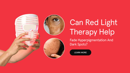 Can Red Light Therapy Help Fade Hyperpigmentation and Dark Spots?