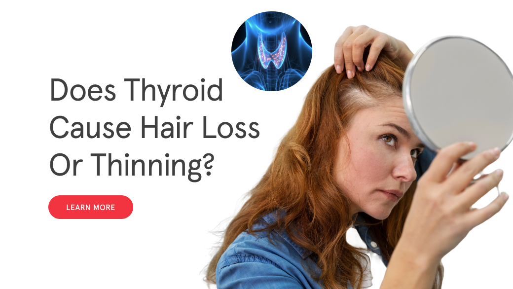 Does Thyroid Cause Hair Loss? What Hypothyroidism and Hyperthyroidism Do to Your Hair