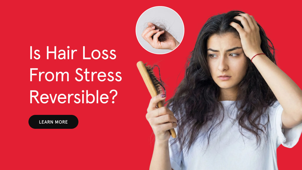 Is Hair Loss from Stress Reversible?