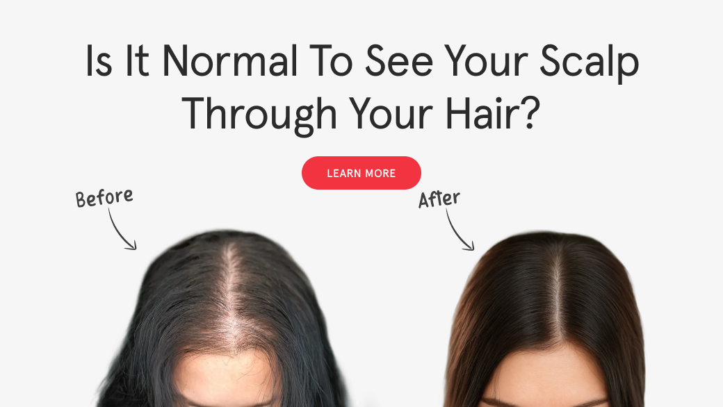 Is It Normal to See Your Scalp Through Your Hair? What’s Normal vs. Warning Signs