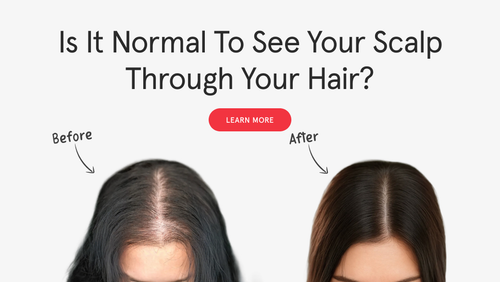 Is It Normal to See Your Scalp Through Your Hair? What’s Normal vs. Warning Signs