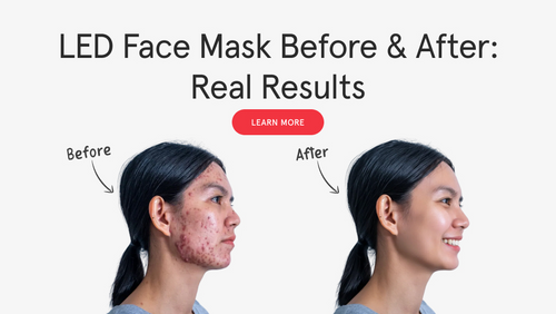 LED Face Mask Before and After: Real Results, Timeline & What to Expect