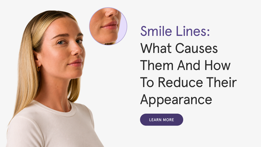 Smile Lines: Causes, Treatments, and How to Reduce Them