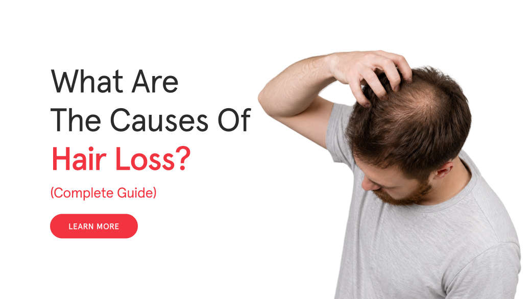What Are the Causes of Hair Loss? (Complete Guide)