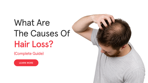 What Are the Causes of Hair Loss? (Complete Guide)