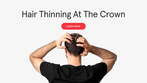 Why Is My Hair Thinning at the Crown? Early Signs & Fixes