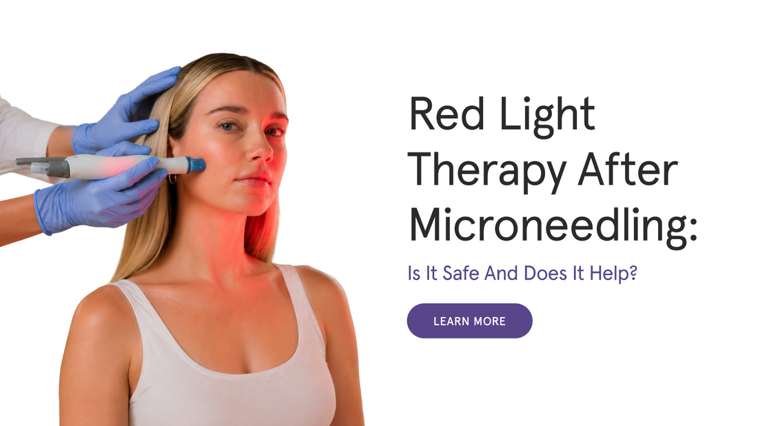 Red Light Therapy After Microneedling: Is It Safe and Does It Help?