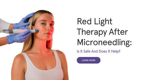 Red Light Therapy After Microneedling: Is It Safe and Does It Help?