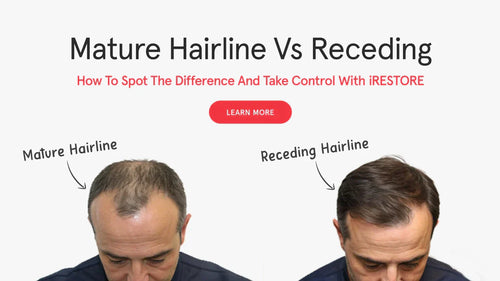 Mature Hairline vs Receding: How to Spot the Difference and Take Control with iRESTORE
