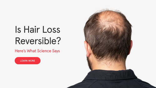 Is Hair Loss Reversible? Here’s What Science Says