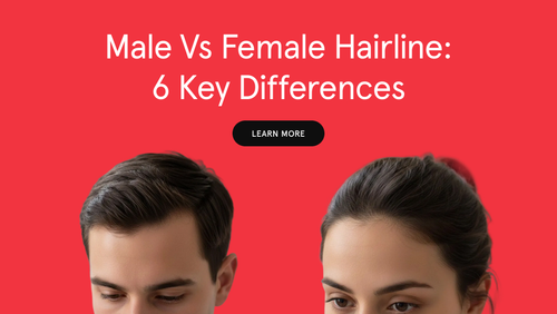 Male vs Female Hairline: 6 Key Differences