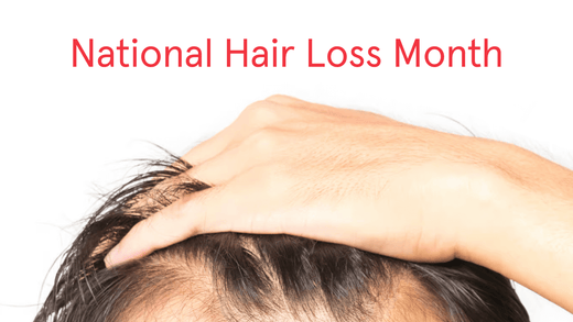 National Hair Loss Month. Image banner showing a close up shot of a man's head.