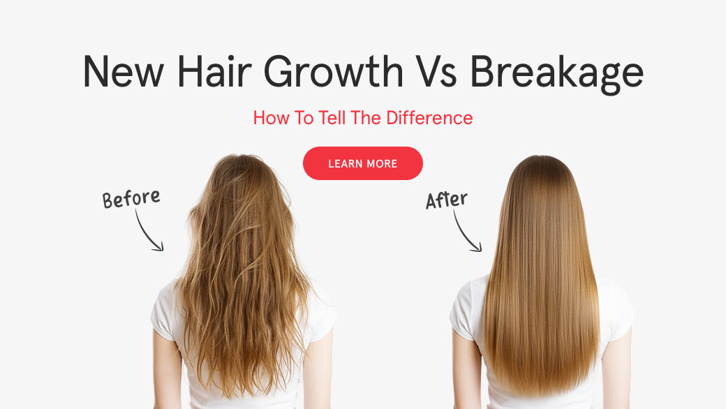 New Hair Growth vs Breakage: How to Tell the Difference