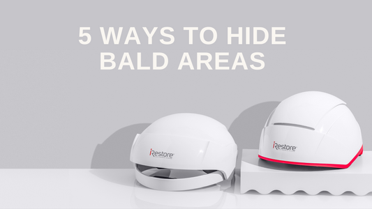 5 Ways to Hide Bald Areas: