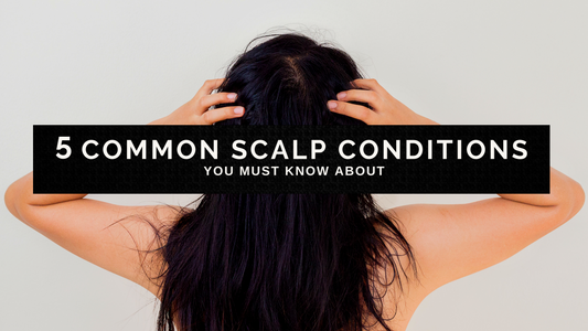 5 Most Common Scalp Conditions You Must Know About
