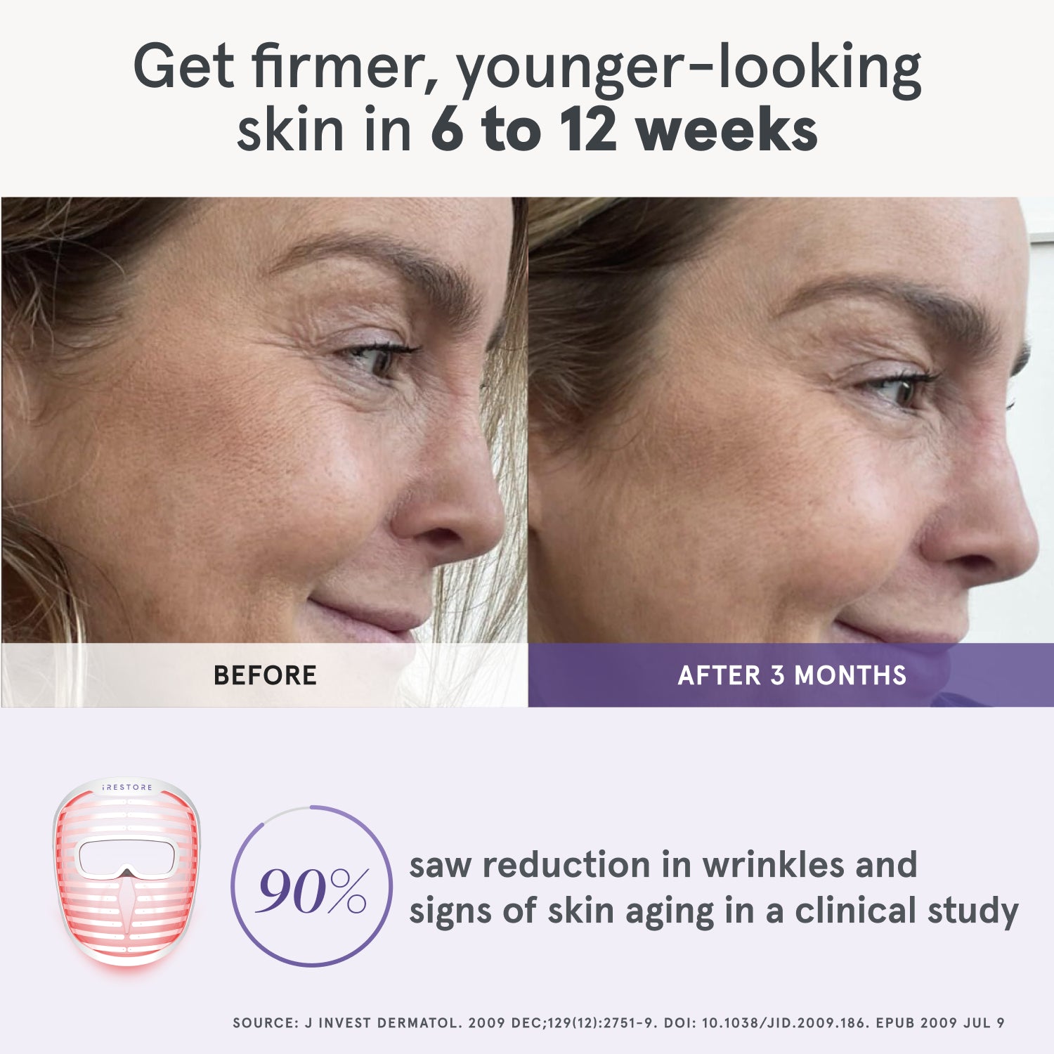 Side-by-side comparison of a woman’s profile showing visible improvements after using the iRESTORE LED face mask for 3 months, with a clinical study statistic highlighting 90% of users experienced reduced signs of aging