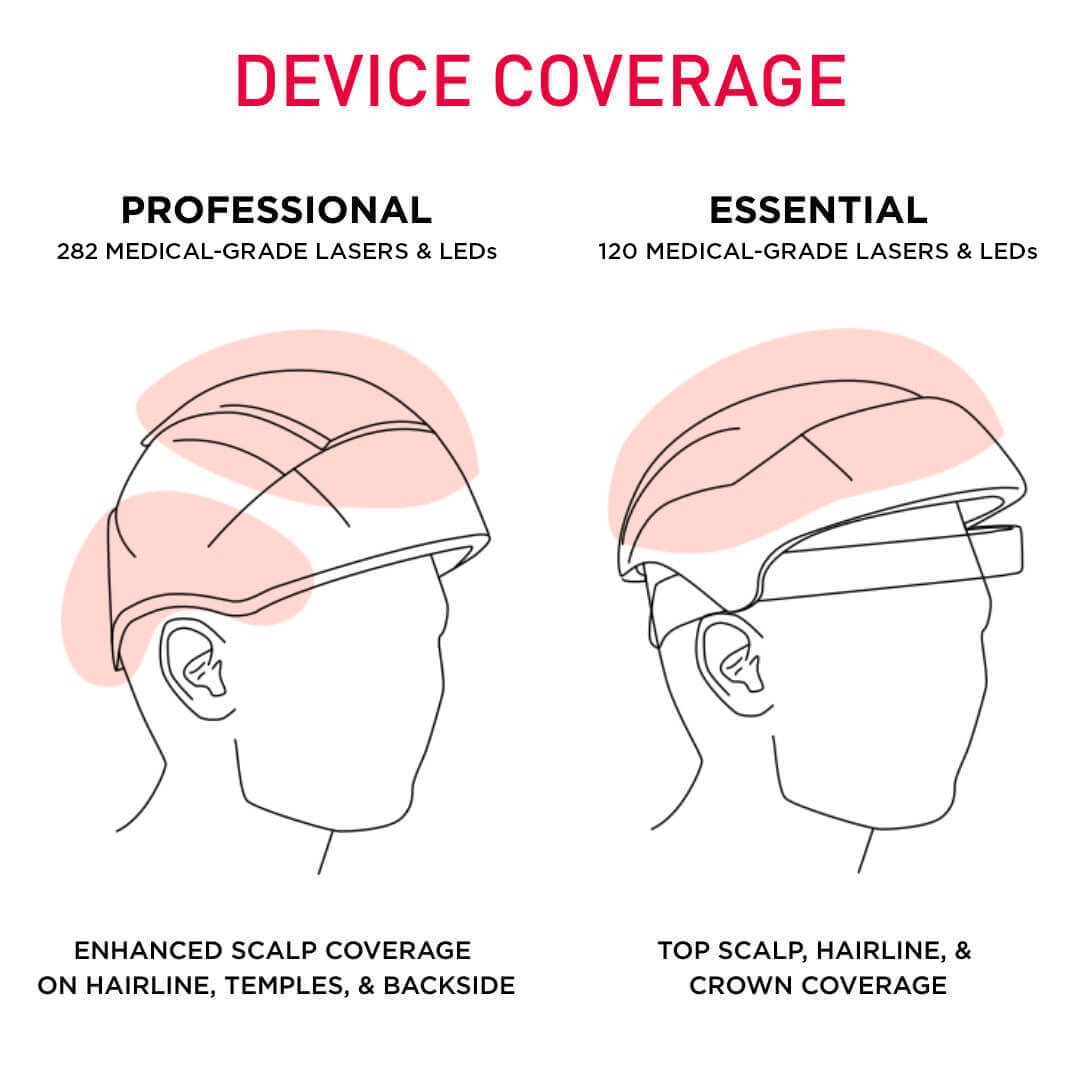 Comparison of device coverage of pro device and essential device