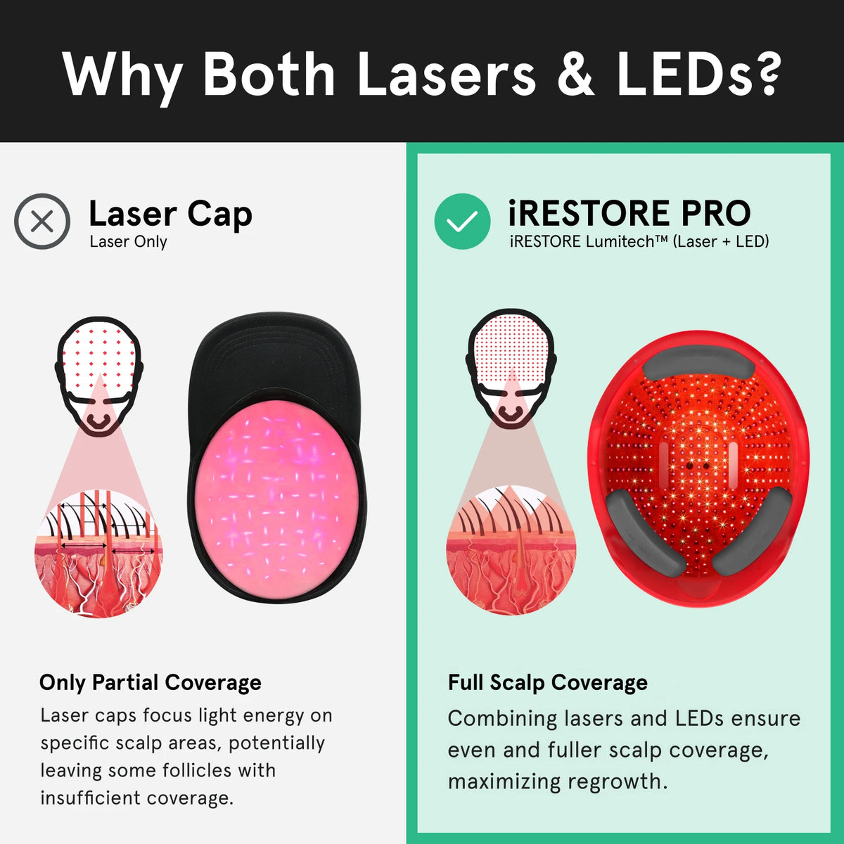 An image comparing the iRESTORE Professional with other laser cap. Laser caps only have partial coverage, laser caps focus light energy on specific scalp areas, potentially leaving some follicles with insufficient coverage. While the Professional device have full scalp coverage, combining lasers and LEDs ensure even and fuller scalp coverage, maximizing regrowth.