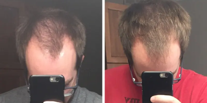 Hair Image
