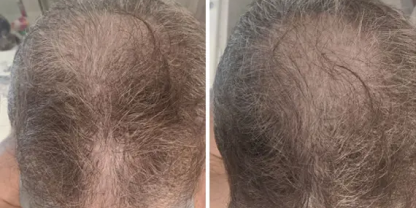 Hair Image