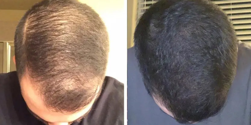 Hair Image
