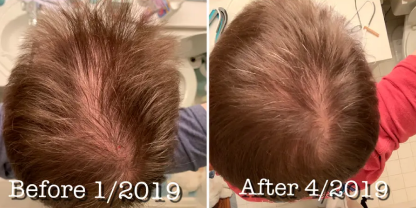 Hair Image