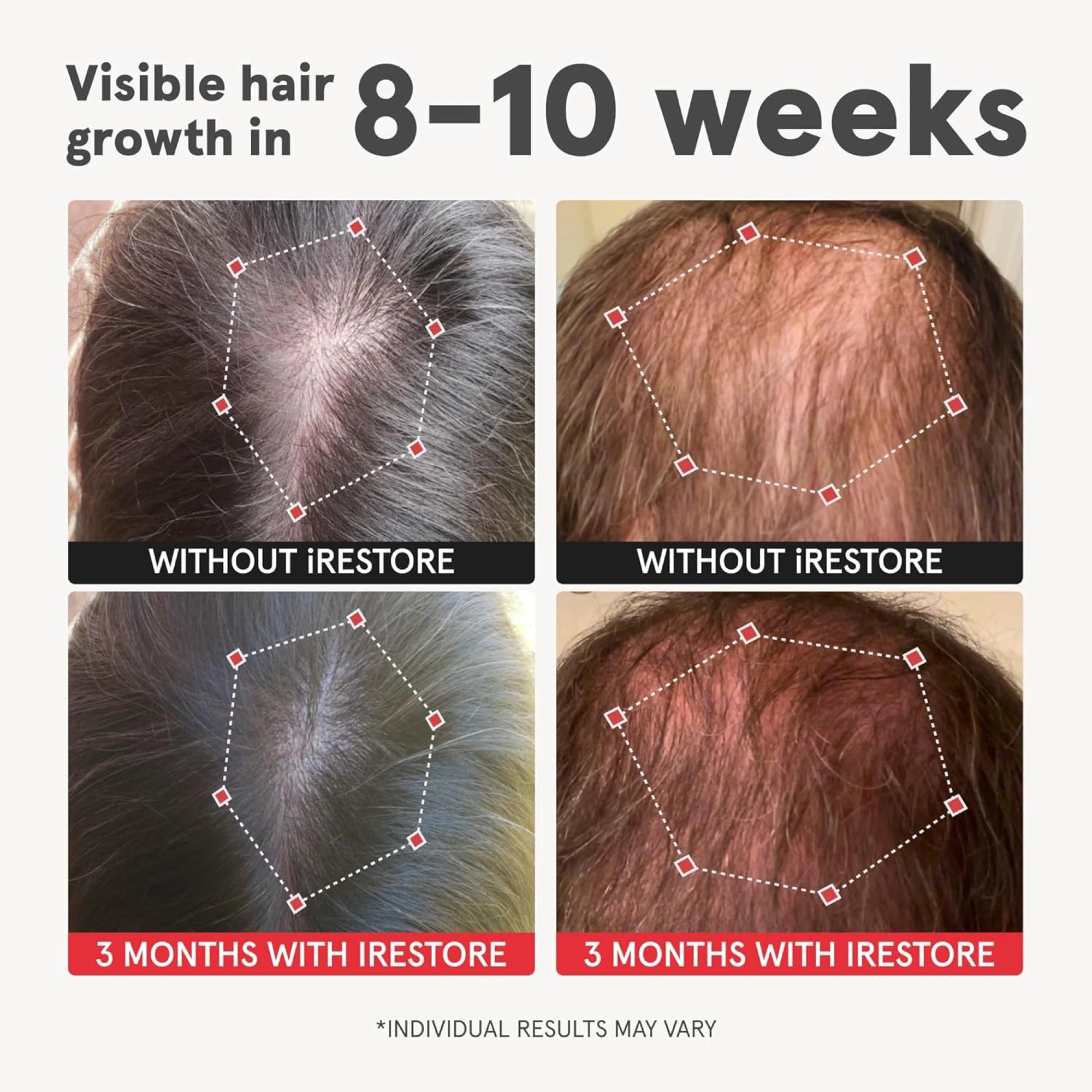 Visible hair growth in 8-10 weeks