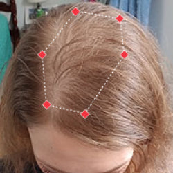 after image showing person with improved hair density