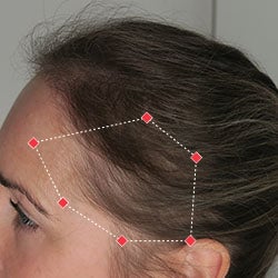 After image of a woman with thicker hair at her temples.