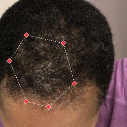 Top down view after image of a woman with thicker hair at the frontal region of her hair.