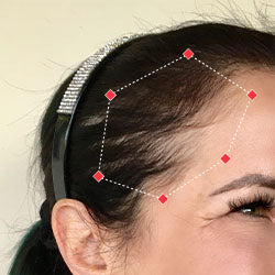 After image of a woman showing the her temples with more thicker hair.
