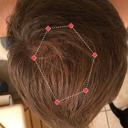 Top down view after image of a man  with thicker hair on his crown.