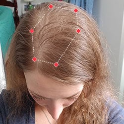 Top down view after image of a woman with thicker hair in her hairline.