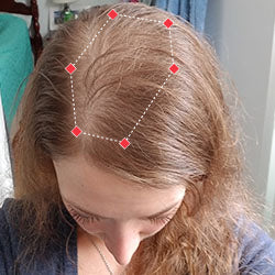 Top down view after image of a woman with thicker hair in her hairline.