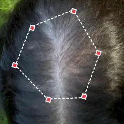 Top down view after image of a woman with thicker hair at the frontal region of her hair.